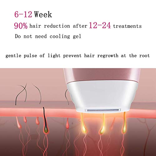 MONESAO IPL Hair Removal System - Painless Permanent IPL Hair Removal Device - With 5 Levels for Different Skin - 400000 Flashes (TUMAKOU-T2 IPL Hair Removal System) - Thumbnail 3