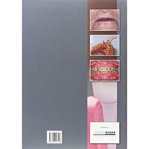 PROTESIS Y ORTODONCIA TECNICO SUPERIOR EN HIGIENE BUCODENTAL