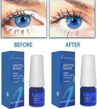 Amazon Co Jp 5 X Innoxa Gouttes Bleues French Eye Drops 5 X 10 Ml 0 35 Fl Oz By Innoxa 並行輸入品 ドラッグストア