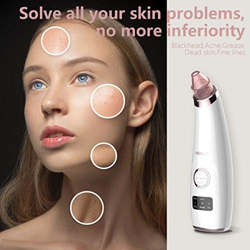 blackhead extractor vacuum