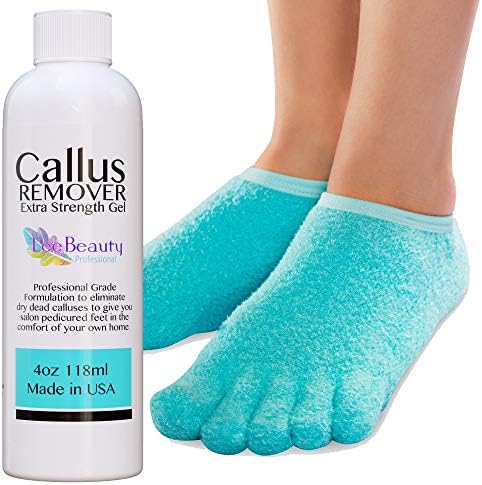 Best Callus Remover.Callus Eliminator,Liquid & Gel For Corn And Callus On Feet. Professional Grade, Does Better Job Than Electric Shaver&Other Scary Tools. (With Moisturizing Socks)