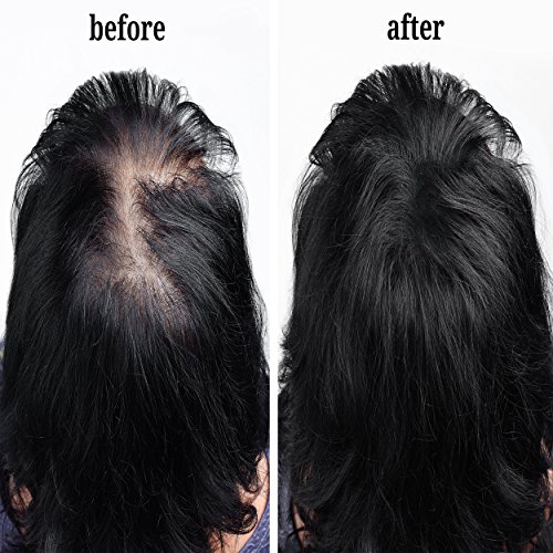 image for Leka HairCare Leka Hair Fibers - Best Keratin Hair Fibers Instantly Th
