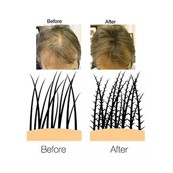 Volumon-Professional-Hair-Building-Fibres-Hair-Loss-Concealer-COTTON-28g-Get-Upto-30-Uses-CHOOSE-FROM-8-HAIR-SHADES-COLOURS-Dark-Brown Volumon Professional Hair Building Fibres- Hair Loss Concealer- COTTON- 28g- Get Upto 30 Uses- CHOOSE FROM 8 HAIR SHADES…