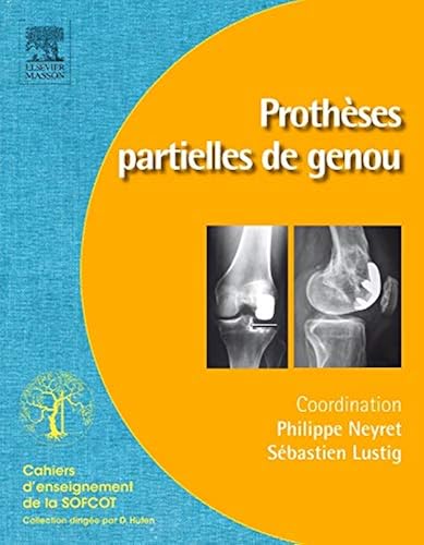 Download Prothèses partielles de genou PDF