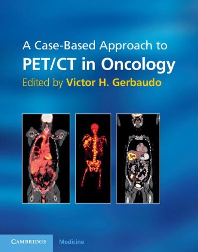 A CASE-BASED APPROACH TO PET/CT IN ONCOLOGY