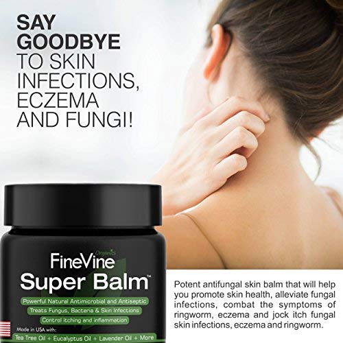 4 Antifungal+Balm+Ringworm+Athletes+Infections