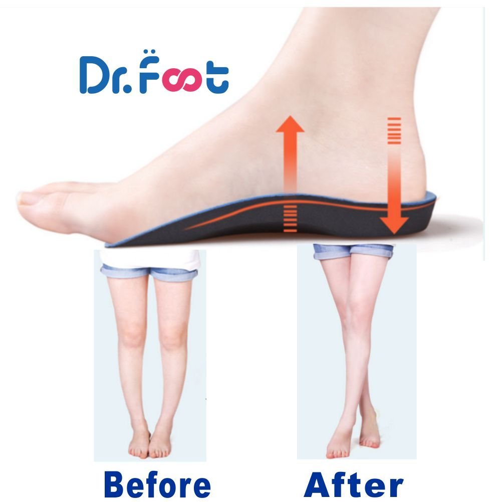 Dr. Foot\'s 3/4 Length Orthotics Insoles - Best Insoles For Corrects Over-pronation,Fallen Arches, Fat Feet - Plantar Fasciitis, Heel Spurs, Bunions, And Other Foot Conditions (S - W7-8.5 | M5.5-7)