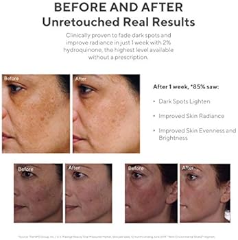 murad fade cream