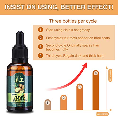 LIUMY Ginger Germinal Oil, Hair Growth Serum-Ginger Essential Oil, Hair Loss Treatment for Women and Men Dense Thicken Hair (30ml)