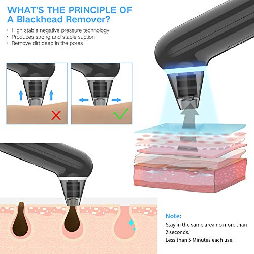 Blackhead Remover Vacuum, Xpreen Pore Cleanser Vacuum with Blue Light - Blackhead and Comedone Acne Extractors - Whitehead Removal, Facial Firming, Oil Reducing for Women & Men - Thumbnail 2