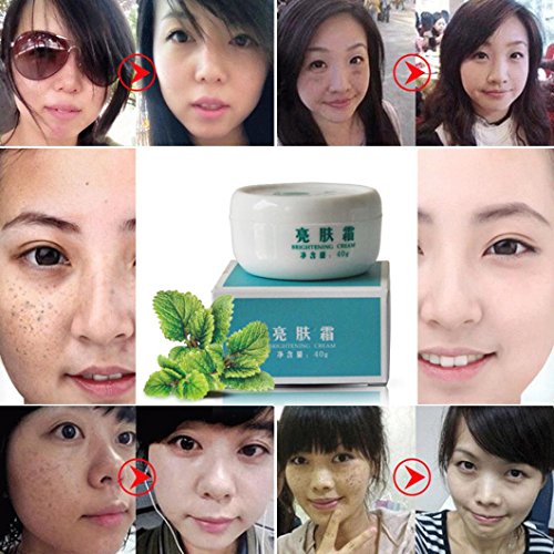 Hometom 40g Whitening Face Skin Care Pigment Freckles Pregnancy Acne Spot Remove Cream (White)