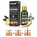 Hair Growth Serum, Hair Loss and Hair Thinning Treatment, Stops Hair Loss, Thinning, Balding, Repairs Hair Follicles, Promotes Thicker, Stronger Hair and New Hair Growththumb 1