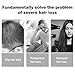 Hair treatment, Hair growth serum, Hair serum,  Natural Herbal Essence Anti Hair Loss Hair Serum , For Longer, Thick,Stronger Hair. Hair serum For Men & Women (30ml)