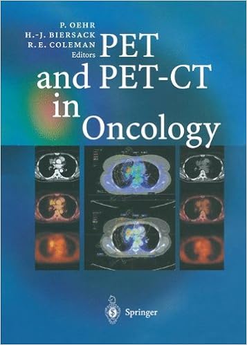 PET and PET-CT in Oncology PET and PET-CT in Oncology