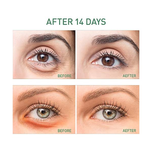 Phichy-Under-Eye-Mask-Collagen-Under-Eye-Patches-New-Upgrade-eye-masks-skincare-Anti-Aging-Anti-Wrinkles-and-Fine-Lines-Reducing-Dark-Circles-Puffy-Eyes-Men-and-Women-Moisturizing-Dark-green Phichy Under Eye Mask, Collagen Under Eye Patches, New Upgrade eye masks skincare, Anti-Aging, Anti-Wrinkles and Fine…