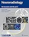 Neuroradiology: The Essentials with MR and CT