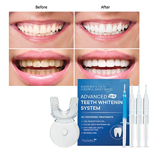 Premium Teeth Whitening Kit, LED Light, 35% Carbamide Peroxide, Safe & Natural At-Home System Without Pain or Sensitivity, Effectively Removes Stains for Whiter Teeth