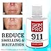 SkinPro Rapid Repair Acne Treatment | The Fastest Working (Medical Grade) Formula | Highly Concentrated Salicylic Acid Solution | Remove Acne and Blackheads Fast