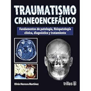 Traumatismo craneoencefalico / Traumatic brain injury (Spanish Edition)