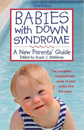 Babies With Down Syndrome A New Parents Guide Susan J -
