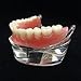 Smile1000 Dental Model Overdenture Inferior 2 Implants Demo for Studing and Teaching