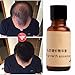 LUCKYFINE Herbal Hair Growth Essence Help Hair Growing Fast Longer