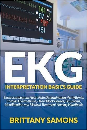 EKG Interpretation Basics Guide: Electrocardiogram Heart Rate Determination, Arrhythmia, Cardiac Dysrhythmia, Heart Block Causes, Symptoms, Identification and Medical Treatment Nursing Handbook, by Brittany Samons EKG Interpretation Basics Guide: Electrocardiogram Heart Rate Determination, Arrhythmia, Cardiac Dysrhythmia, Heart Block Causes, Symptoms, Identification and Medical Treatment Nursing Handbook, by Brittany Samons