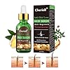 Hair-Growth-SerumHair-Loss-Hair-Thinning-TreatmentHair-SerumStimulates-New-Hair-Growth-Promotes-Thicker-Fuller-and-Faster-Growing-Hair Hair Growth Serum, Hair Loss &Hair Thinning Treatment, Hair Serum, Stimulates New Hair Growth, Promotes Thicker, Fuller…