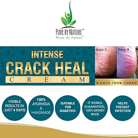 Pure By Nature Ayurveda Handmade Hypoallergenic Crack Heal Cream 50G