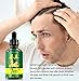 Ginger Germinal Oil, Hair Growth Oil, 2019 Hair Growth Ginger Essential Oil, Ginger Germinal Essential Oil，Hair Loss Treatment Hair Care Hair Growth Serum for Men & Women 30mlthumb 3