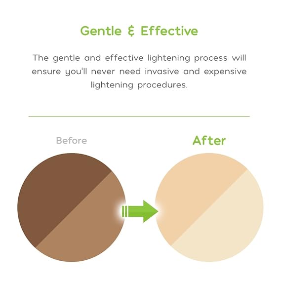 amaira bleaching reviews