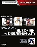 Techniques in Revision Hip and Knee Arthroplasty E-Book: Expert Consult by Giles R Scuderi