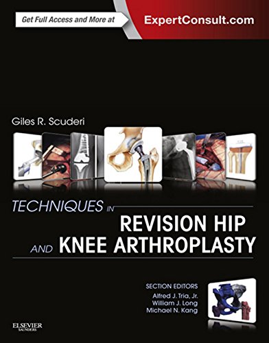 Techniques in Revision Hip and Knee Arthroplasty E-Book: Expert Consult by Giles R Scuderi