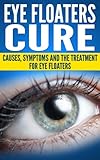 Eye Floaters Cure (Health and Wellness)