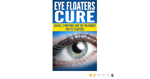 Eye Floaters Cure Health And Wellness Kindle Edition By Gray William Health Fitness Dieting Kindle Ebooks Amazon Com
