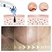 Blackhead Remover, Blackhead Extractor Acne Remover Facial Pore Cleanser Microdermabrasion Set SROCKER Newest Standable USB Rechargeable 5 Adjustable Suction Power with 4 Multi-Functional Probe