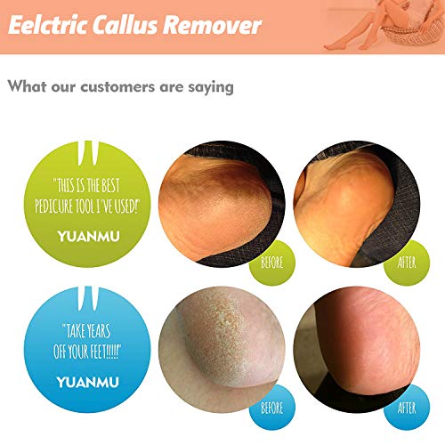 Electronic Foot File with Replacement Sandpaper Discs, Professional