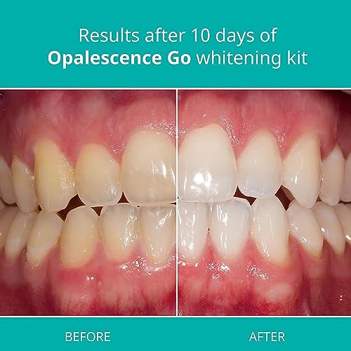 Opalescence Go Prefilled Teeth Whitening Trays 15 Hydrogen