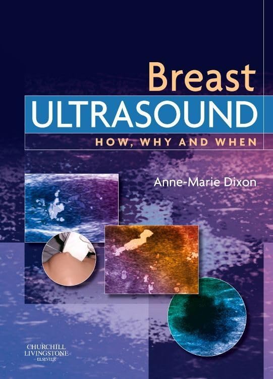 Breast Ultrasound: 9780397516247: Medicine & Health Science Books 