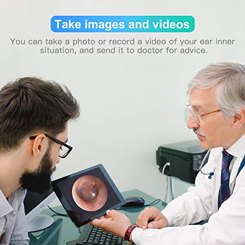 Teslong Digital Otoscope, Visual Ear Wax Removal Tool with HD Ear