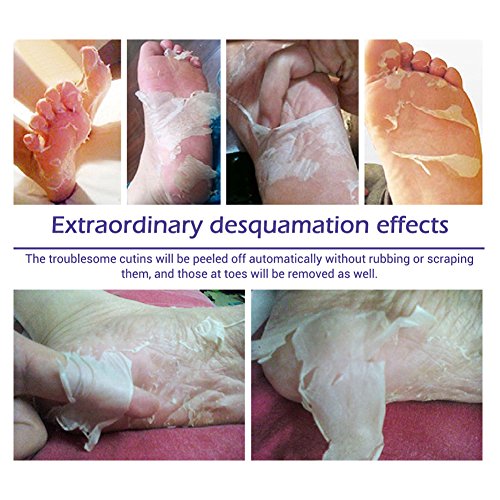 baby feet callus remover