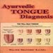 Ayurvedic Tongue Diagnosis 8120832310 Book Cover