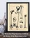 Hip and Leg Bones Book Print - Vintage Human Bones Anatomy Decor, Science Lab Wall Prints, Classic Medical Orthopedic and Nursing Student Gift, 11x14 Unframed Art Print Poster