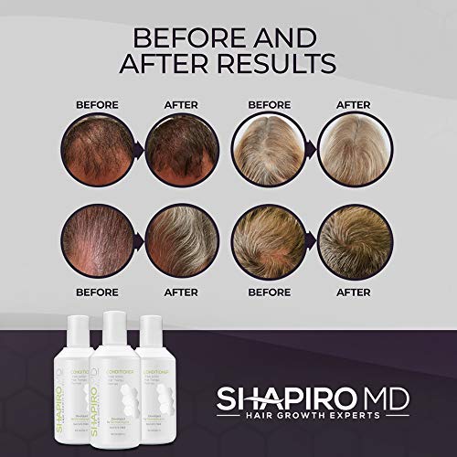 Hair Loss Conditioner | All-Natural DHT Blockers for Thinning Hair Developed by Dermatologists | Exp - //medicalbooks.filipinodoctors.org