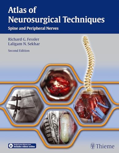 ExpertDDx: Brain and Spine: 9780443106941: Medicine & Health