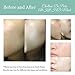 CHALLANS de PARIS Anti Blemish & Skin Repairing Facial Sheet Masks for Sensitive Skin (10 Sheets) | Improves Skin Redness & Minor Acne Scars | Adenosine, Centella Asiatica Extract, Niacinamide