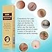 Scar Cream, Acne Scar Removal Cream,Acne Spots Treatment,Stretch Marks Relief and Burns Repair,Face Skin Repair Cream 30ml
