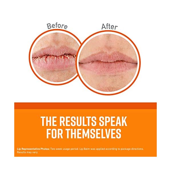 OKeeffes-Lip-Repair-Stick-42-g O'Keeffe's Lip Repair Unscented Lip Balm, 4.2g – For Extremely Dry, Cracked Lips | All-Day Moisture with 7 Moisturising…