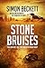 Stone Bruises