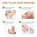 Samsali Wart Remover Pads, Highly Potent Wart Removal Treatment, All New Premium High Efficacy Wart Remover Pads, 42 Wart Remover Padsthumb 2
